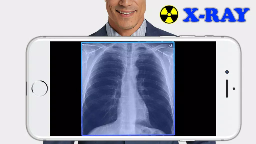 X-Ray Filter Photo Ảnh chụp màn hình 0