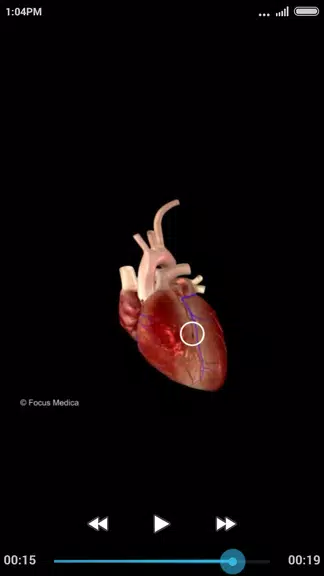 Cardiology-Animated Dictionary Tangkapan skrin 2