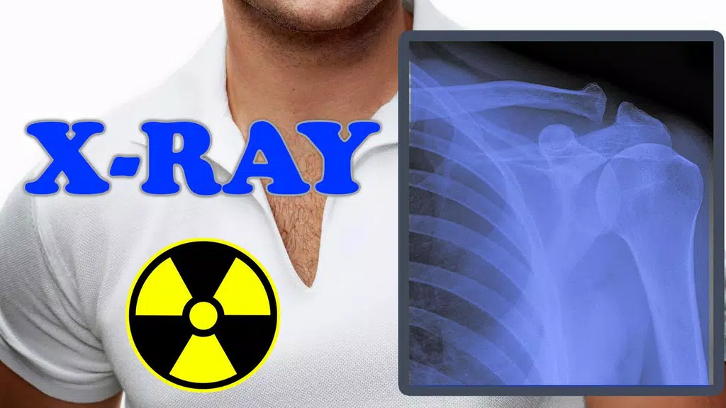 X-Ray Filter Photo Ảnh chụp màn hình 2