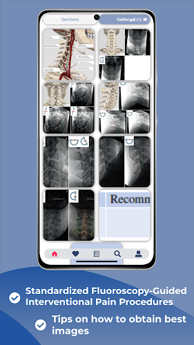 Interventional Pain App应用截图第2张